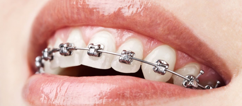 Como os dente se movimentam?